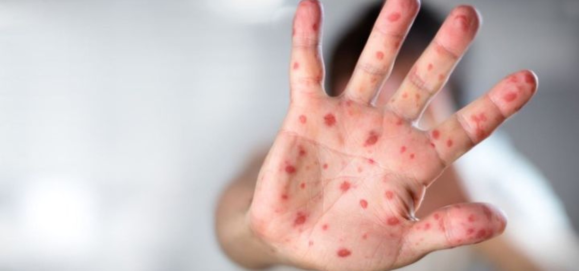 Έκθεση επιτήρησης αναπνευστικών ιών 2024, εβδομαδα 5 (29 Ιανουαρίου - 4 Φεβρουαρίου)