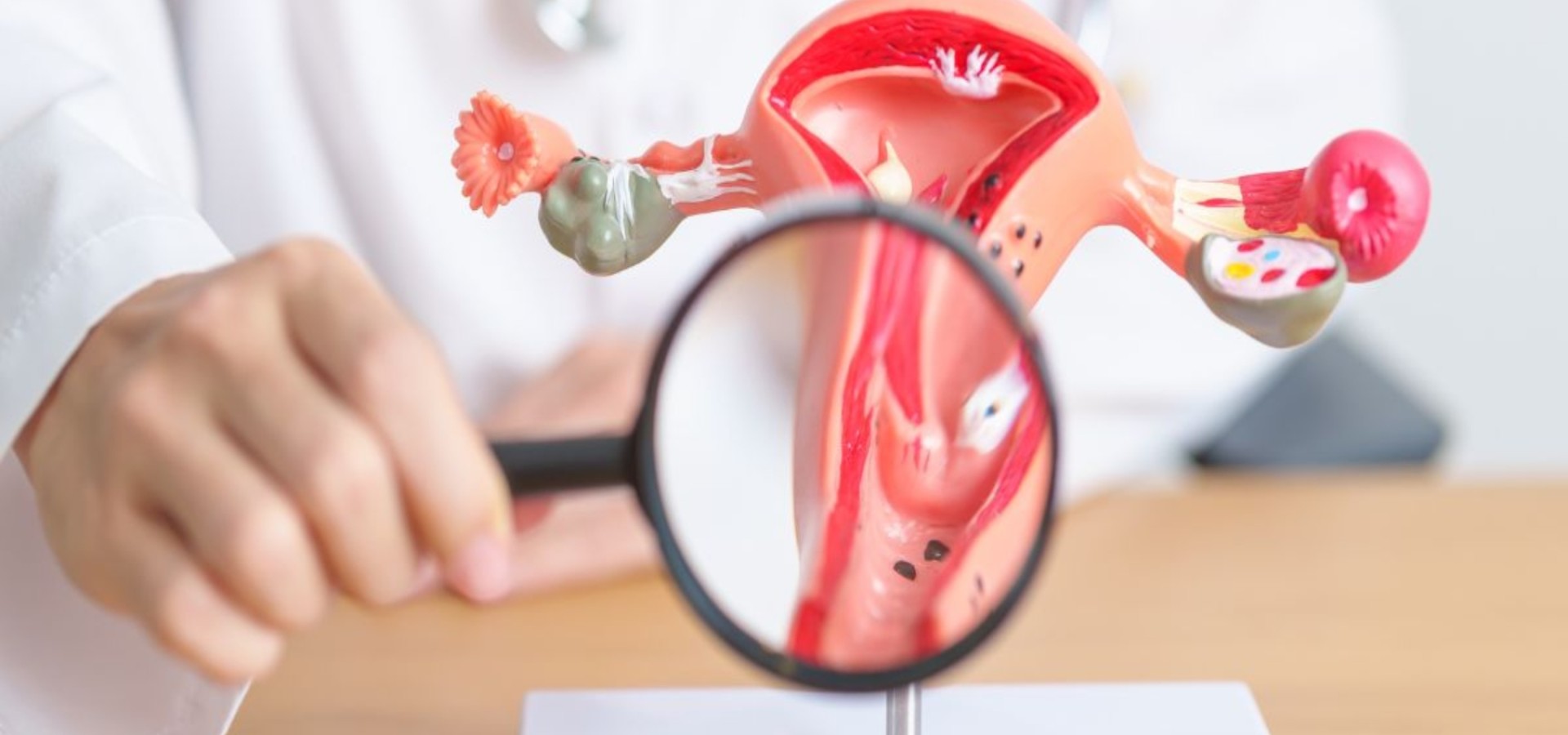 Τι πρέπει να γνωρίζετε για τον καρκίνο του τραχήλου της μήτρας