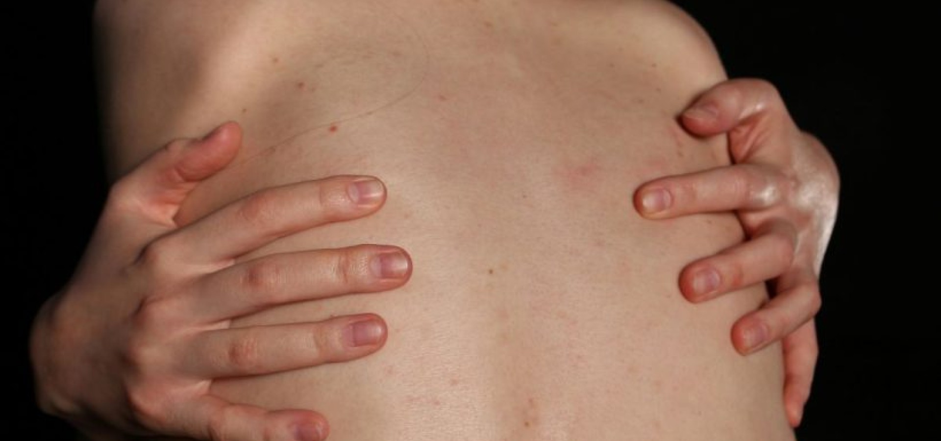 Γυναικείες θhλές: To σ3ξουαλικοπoιημένο σώμα τρώει ban στα social